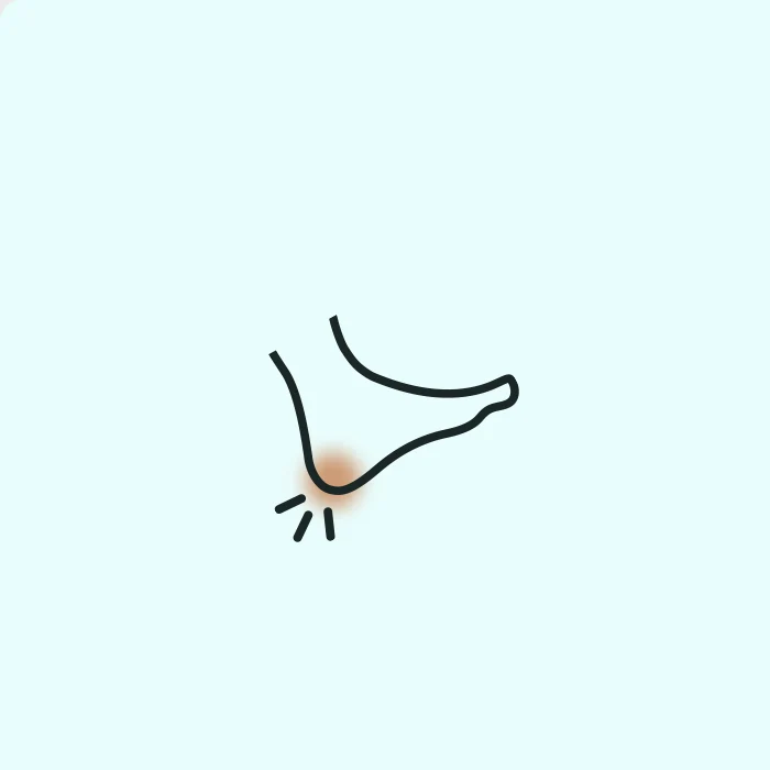 Heel Pain